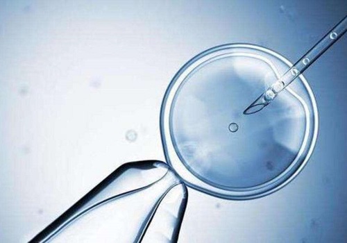 做美國(guó)試管嬰兒大概需要多少錢